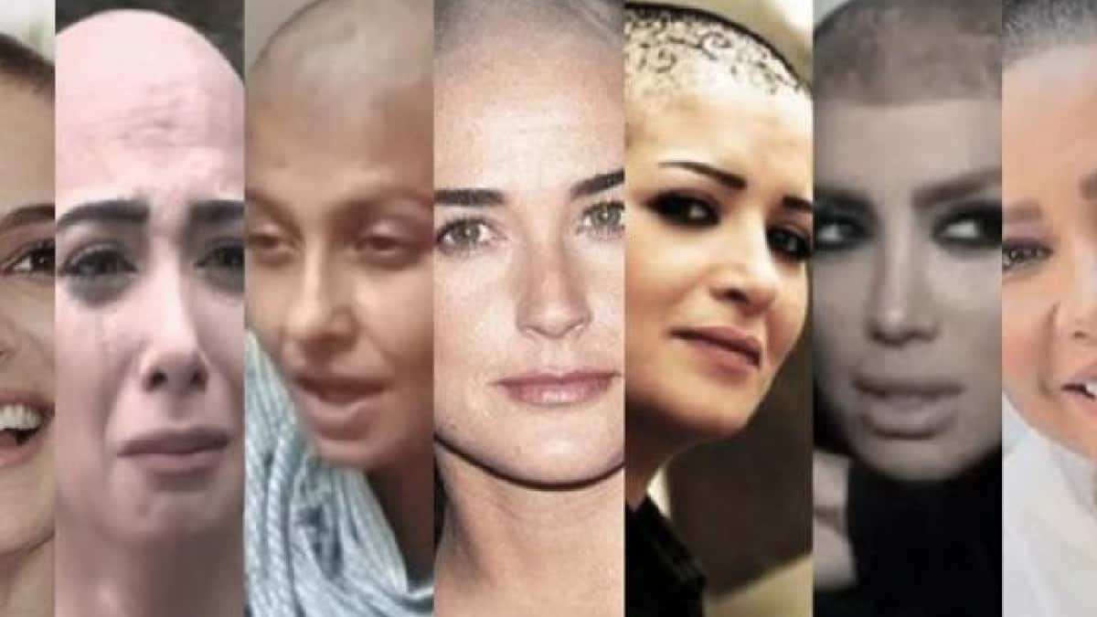 شيرين ليست الأولى| أبرز النجمات اللواتى حلقن شعرهم بالكامل
