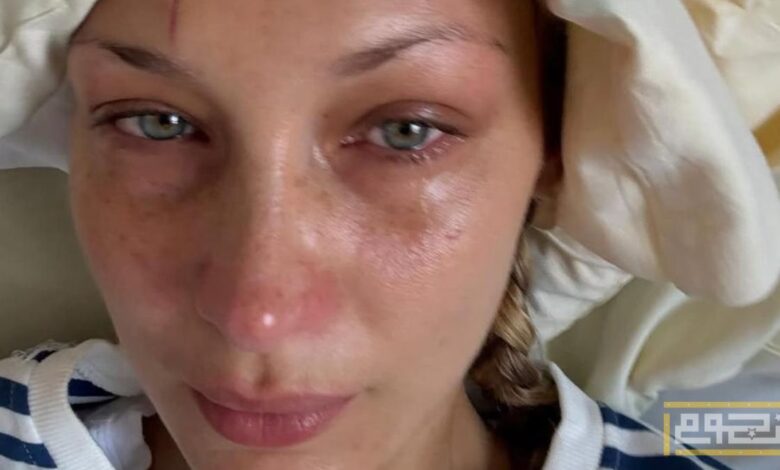 بيلا حديد تظهر باكية وتقلق الجمهور على حالتها الصحية مجدداً