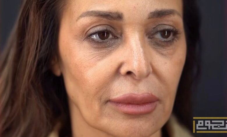 السبب الحقيقي لخضوع داليا البحيري لعملية شد الوجه؟