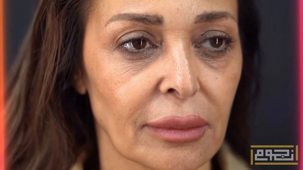 السبب الحقيقي لخضوع داليا البحيري لعملية شد الوجه؟
